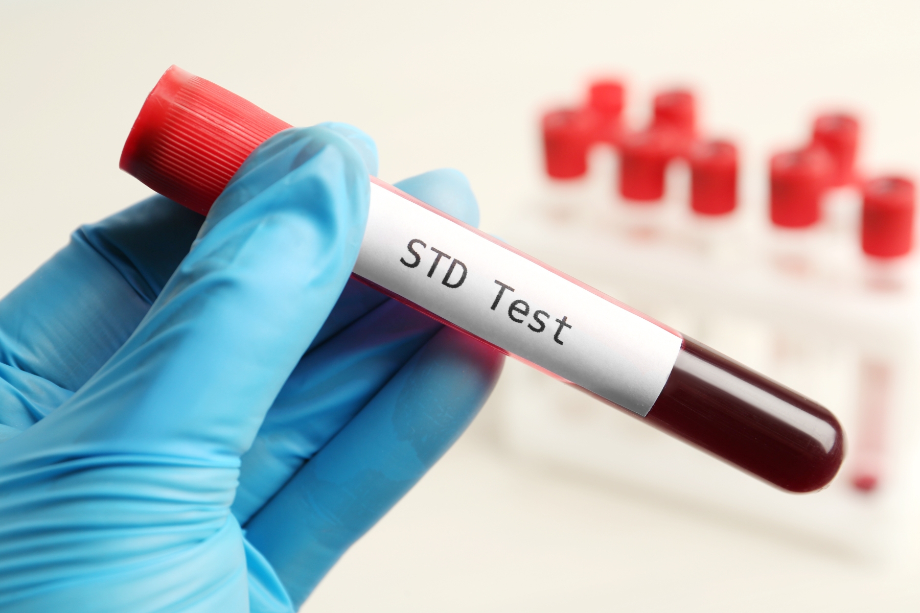 STD-Blood-Test-sample